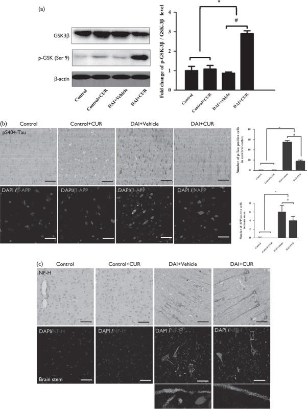 https://cdn.ncbi.nlm.nih.gov/pmc/blobs/b04a/5959262/3702b176ff04/wnr-29-661-g007.jpg