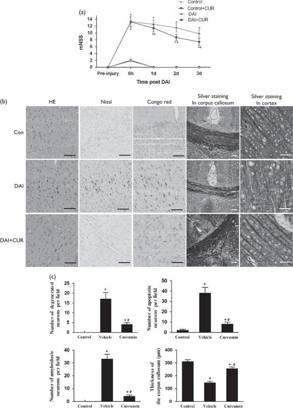 https://cdn.ncbi.nlm.nih.gov/pmc/blobs/b04a/5959262/c53be5c406b3/wnr-29-661-g002.jpg