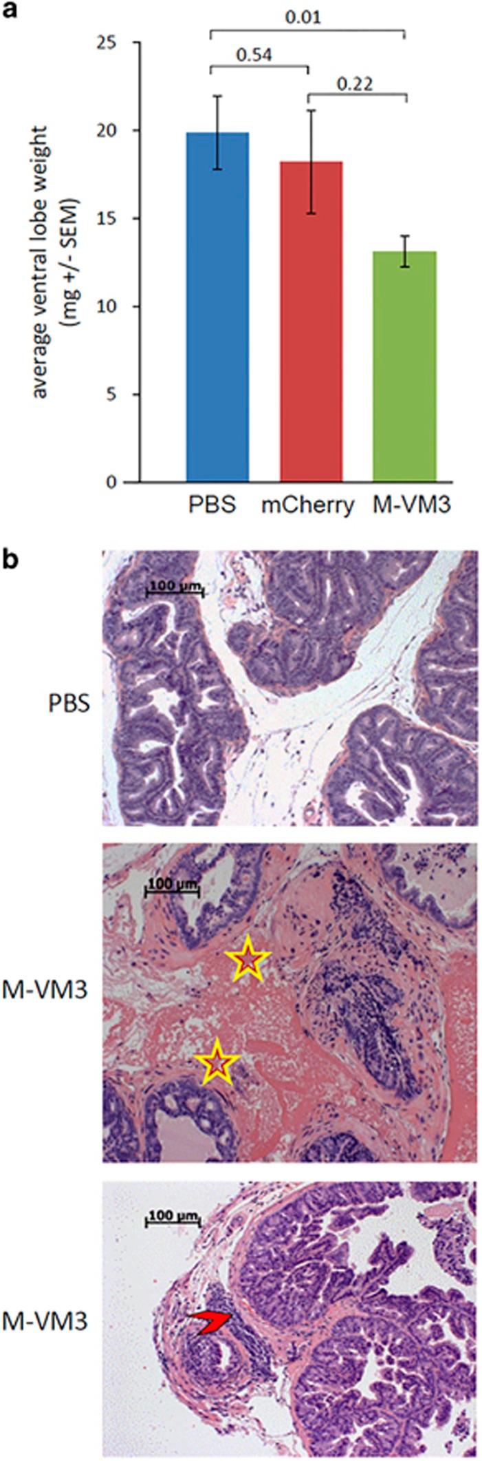 https://cdn.ncbi.nlm.nih.gov/pmc/blobs/b04d/5799711/bc3962453b76/onc2017346f4.jpg