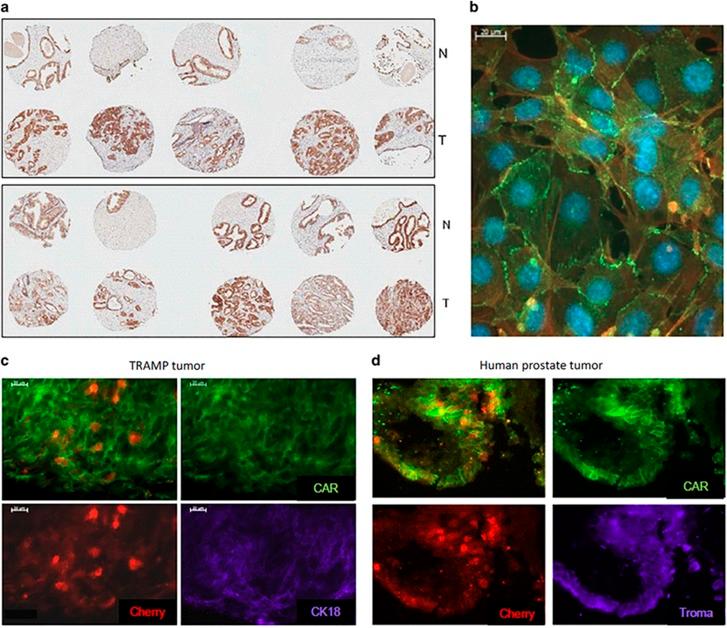 https://cdn.ncbi.nlm.nih.gov/pmc/blobs/b04d/5799711/facc0806c85a/onc2017346f2.jpg