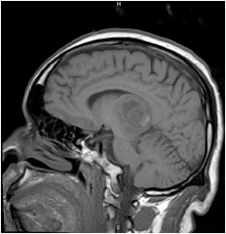 https://cdn.ncbi.nlm.nih.gov/pmc/blobs/b04f/6076220/26d12bcbb2fd/gr1.jpg