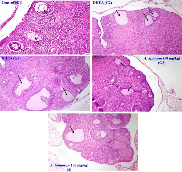 https://cdn.ncbi.nlm.nih.gov/pmc/blobs/b064/12091212/4623f2a9b4a4/FSN3-13-e70314-g002.jpg