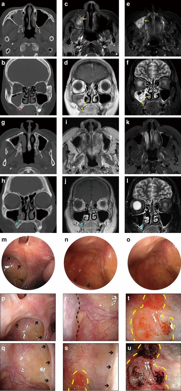 https://cdn.ncbi.nlm.nih.gov/pmc/blobs/b064/9485168/2cca686057f2/464_2022_9410_Fig3_HTML.jpg