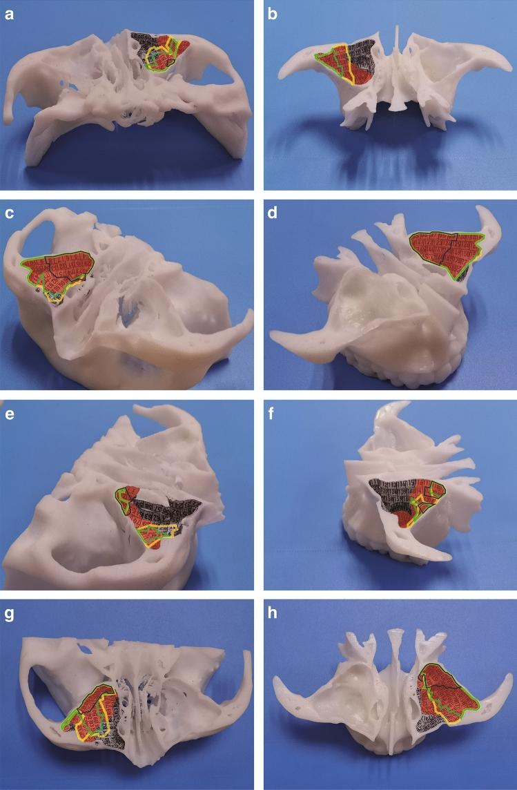 https://cdn.ncbi.nlm.nih.gov/pmc/blobs/b064/9485168/ab3ee5212e93/464_2022_9410_Fig5_HTML.jpg