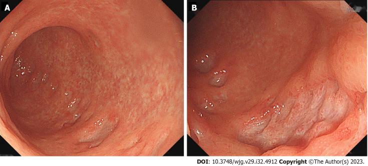 https://cdn.ncbi.nlm.nih.gov/pmc/blobs/b065/10494761/c708f1eeea61/WJG-29-4912-g001.jpg