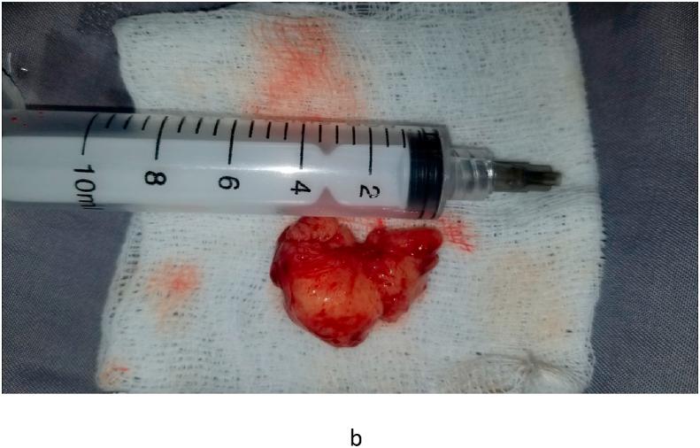 https://cdn.ncbi.nlm.nih.gov/pmc/blobs/b065/8692994/6f55bc6d7930/gr2b.jpg