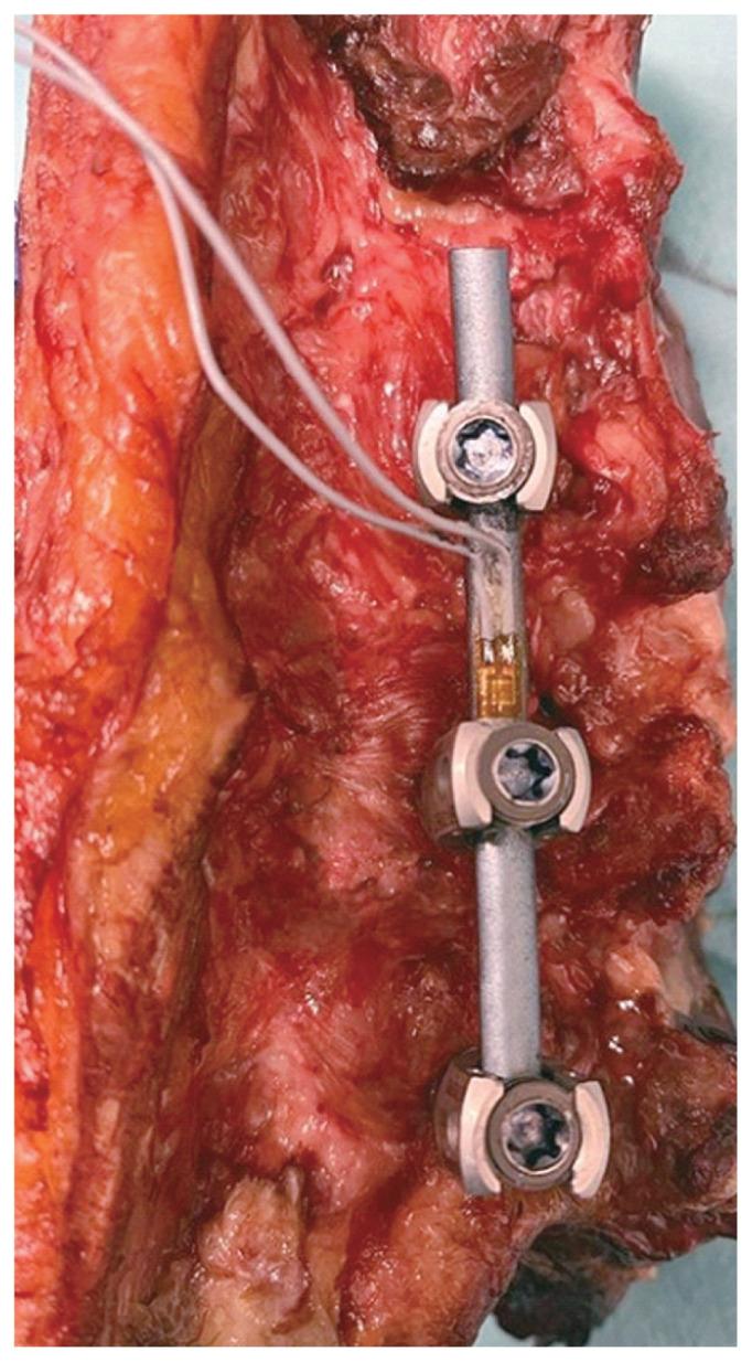 https://cdn.ncbi.nlm.nih.gov/pmc/blobs/b069/11366558/d518a5d5db66/asj-2024-0073f1.jpg