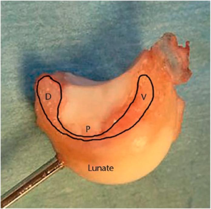 https://cdn.ncbi.nlm.nih.gov/pmc/blobs/b070/11133945/1280562cf6a1/gr5.jpg