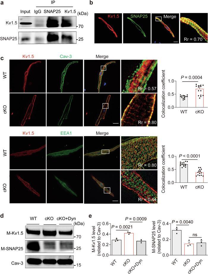https://cdn.ncbi.nlm.nih.gov/pmc/blobs/b075/12009440/686fbe3009f9/41467_2025_59096_Fig6_HTML.jpg