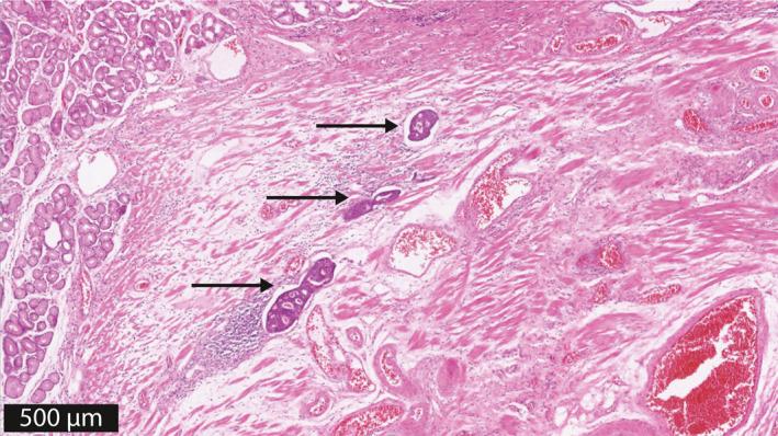 https://cdn.ncbi.nlm.nih.gov/pmc/blobs/b075/8598963/62b347ffa04f/UEG2-9-1066-g002.jpg