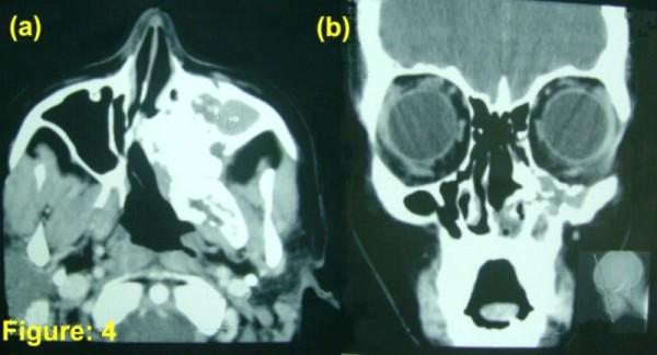 https://cdn.ncbi.nlm.nih.gov/pmc/blobs/b077/3195723/d7a652bcb9b4/1477-7819-9-118-4.jpg