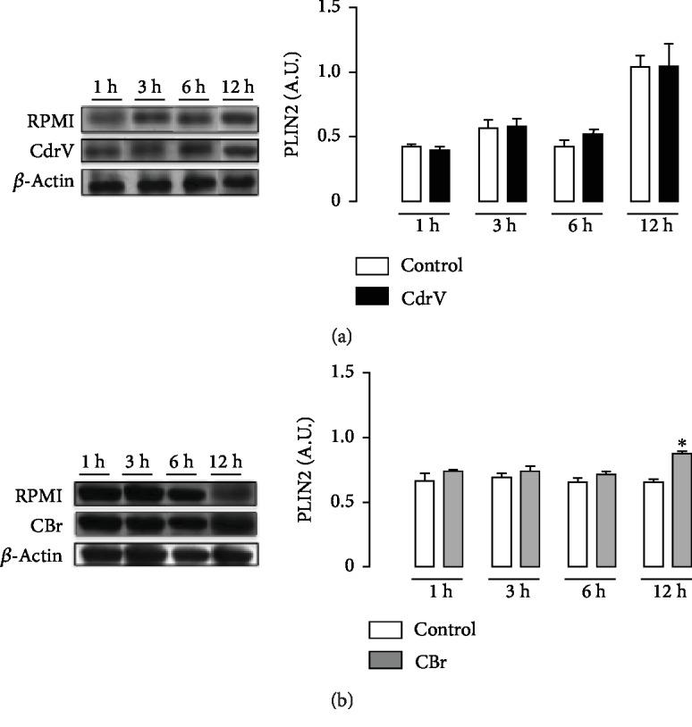 https://cdn.ncbi.nlm.nih.gov/pmc/blobs/b077/6875421/78e9bc034858/JIR2019-2745286.005.jpg