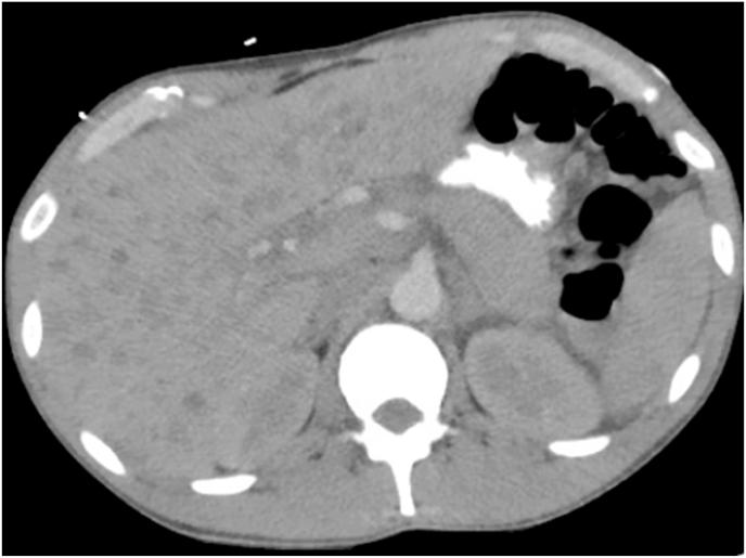 https://cdn.ncbi.nlm.nih.gov/pmc/blobs/b079/8501763/8de17d5df527/gr3.jpg