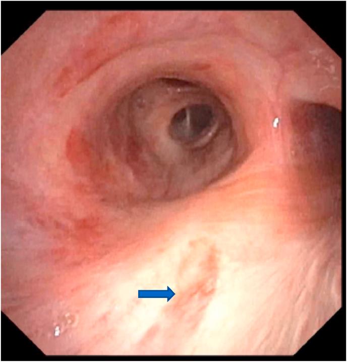 https://cdn.ncbi.nlm.nih.gov/pmc/blobs/b079/8501763/f4cf0ec3ecb0/gr5.jpg