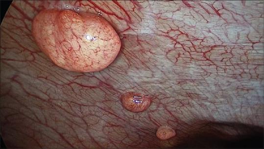 https://cdn.ncbi.nlm.nih.gov/pmc/blobs/b083/6135166/e50f72f63b15/GMIT-7-124-g002.jpg