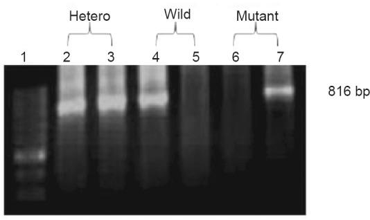 https://cdn.ncbi.nlm.nih.gov/pmc/blobs/b084/4989831/3c25c9948951/IJMR-143-581-g007.jpg