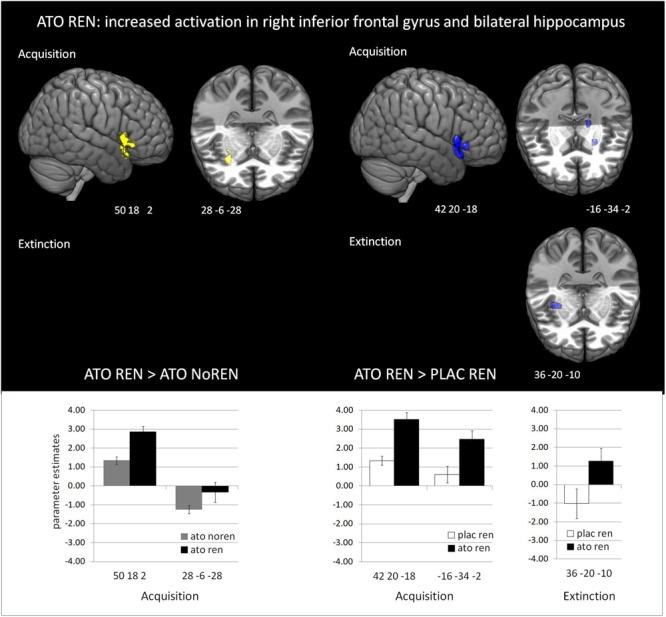 https://cdn.ncbi.nlm.nih.gov/pmc/blobs/b086/6491890/32b0f23ef481/fnbeh-13-00078-g004.jpg