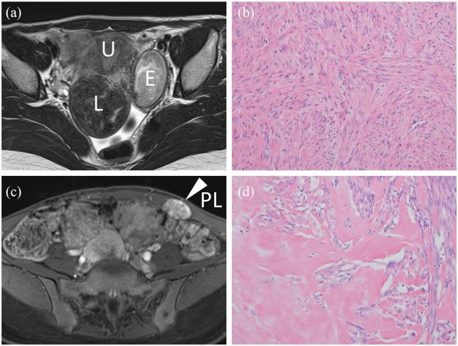 https://cdn.ncbi.nlm.nih.gov/pmc/blobs/b086/7502794/980f1077a204/10.1177_2050313X20959223-fig1.jpg