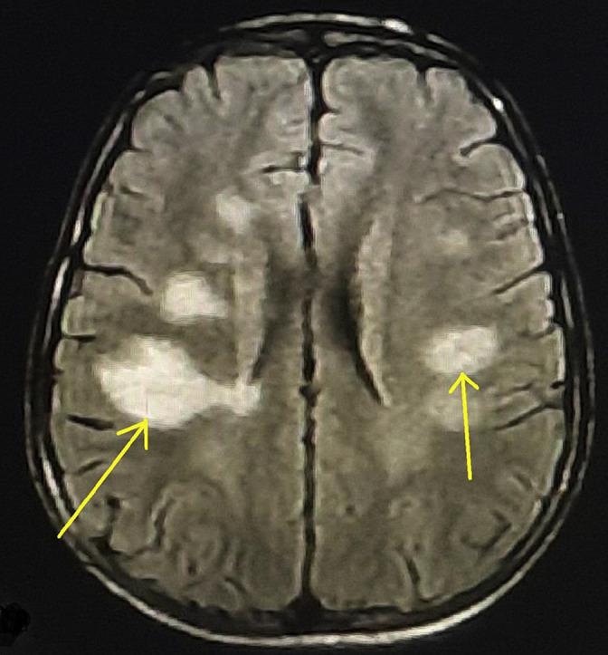 https://cdn.ncbi.nlm.nih.gov/pmc/blobs/b086/8243636/753bed6bf152/ga1_lrg.jpg