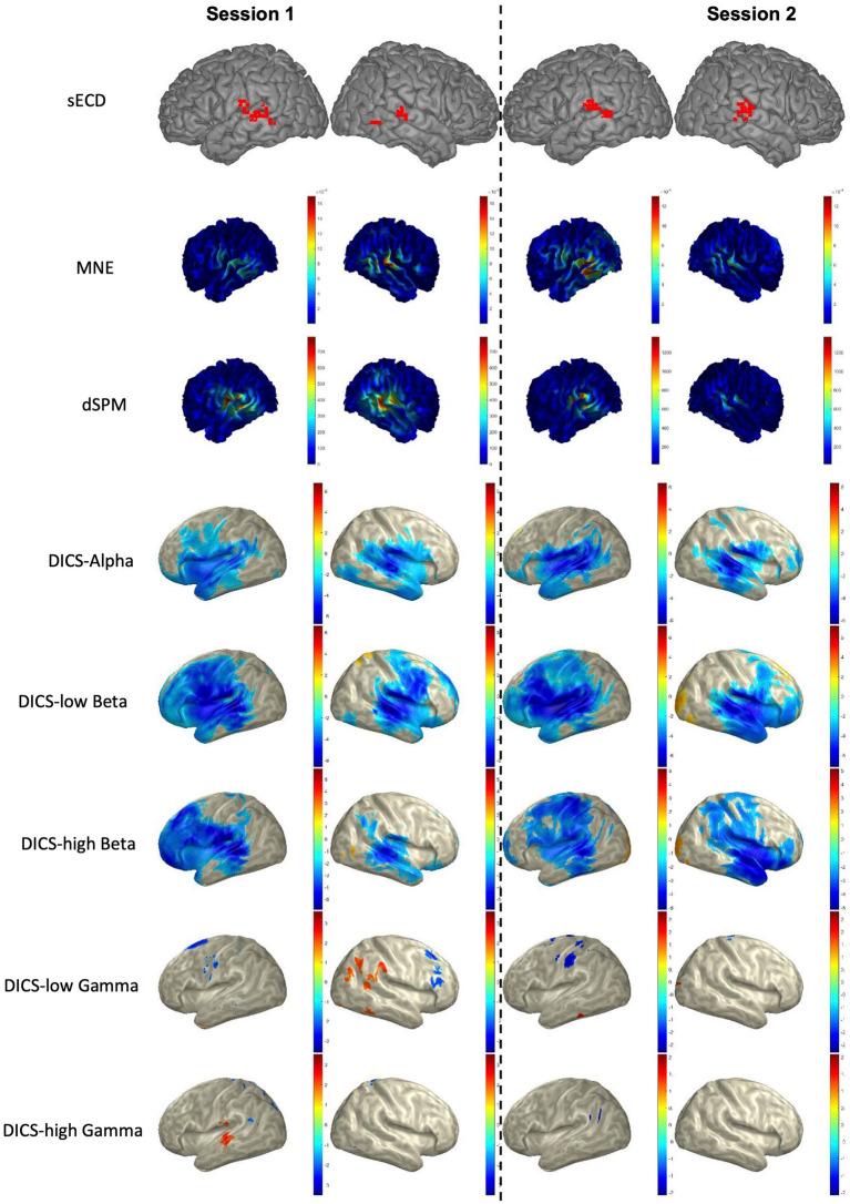 https://cdn.ncbi.nlm.nih.gov/pmc/blobs/b08d/10272516/720d250be6be/fnins-17-1151885-g004.jpg