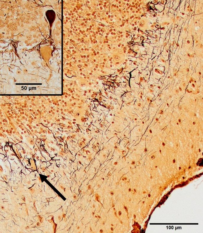 https://cdn.ncbi.nlm.nih.gov/pmc/blobs/b08f/4913561/0bc063860504/JVIM-30-813-g002.jpg