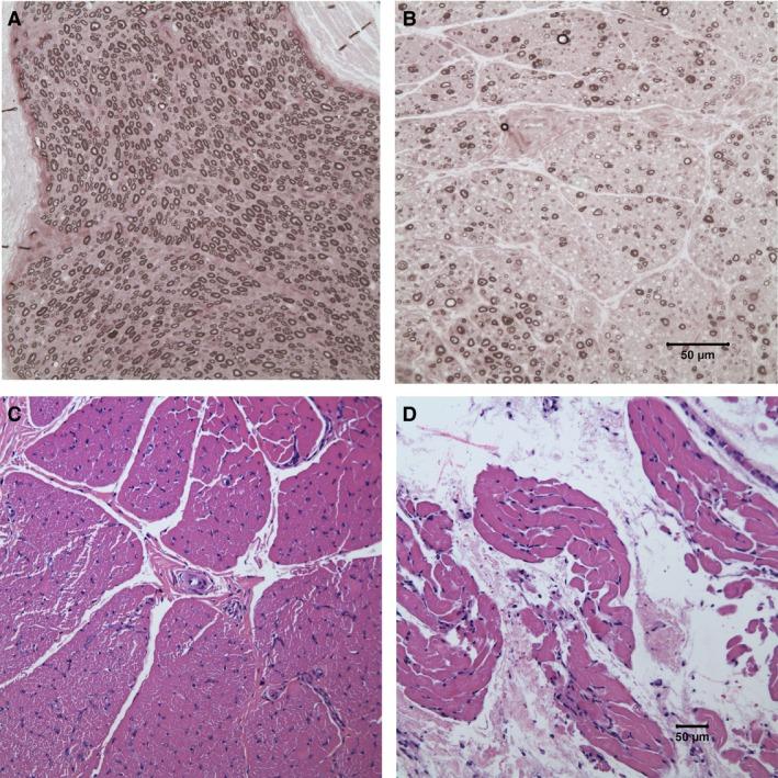 https://cdn.ncbi.nlm.nih.gov/pmc/blobs/b08f/4913561/496ac0737f2a/JVIM-30-813-g003.jpg