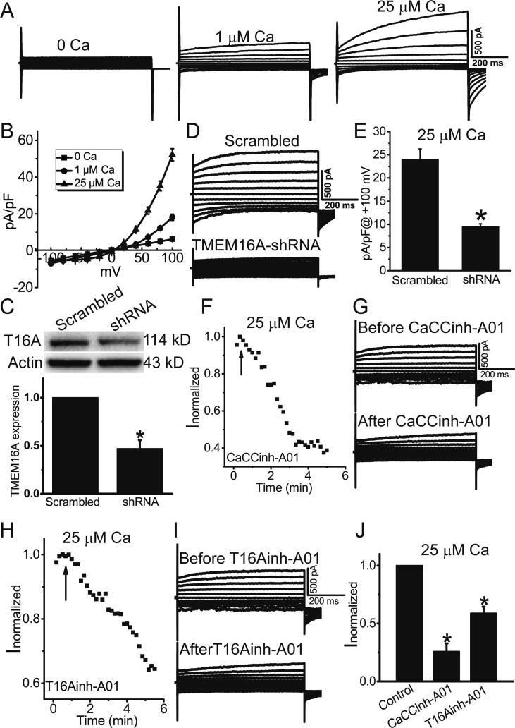https://cdn.ncbi.nlm.nih.gov/pmc/blobs/b092/8020148/0ed3059a2552/gr1.jpg