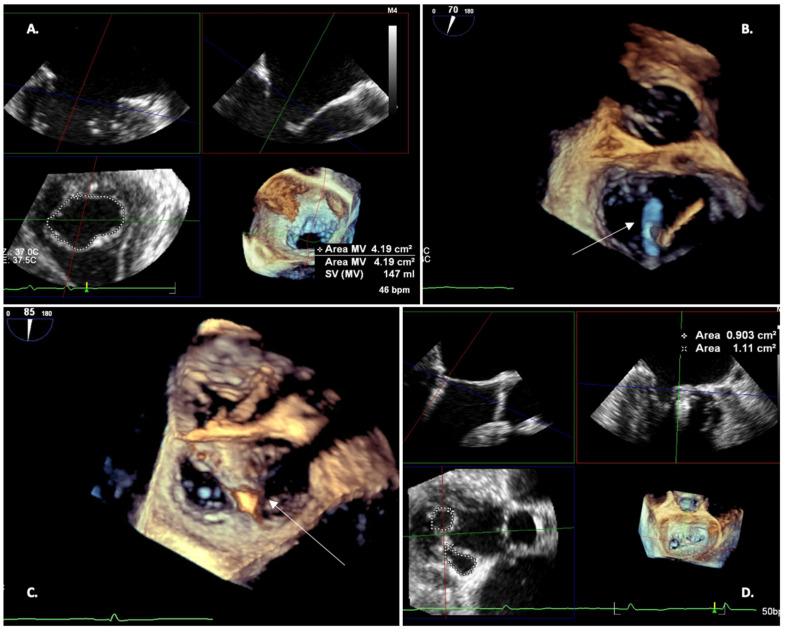 https://cdn.ncbi.nlm.nih.gov/pmc/blobs/b095/10672624/ac1d33bc6e5c/jcm-12-07121-g006.jpg