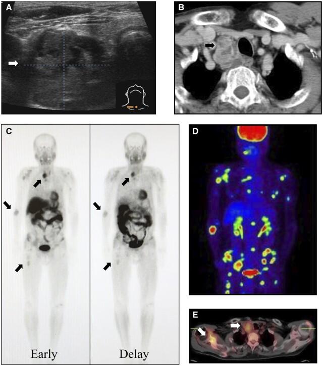 https://cdn.ncbi.nlm.nih.gov/pmc/blobs/b09c/10860522/42888f434bc3/uaad003f1.jpg