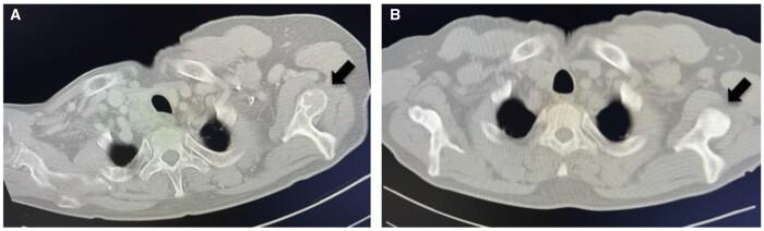 https://cdn.ncbi.nlm.nih.gov/pmc/blobs/b09c/10860522/4d55ae2b9ca7/uaad003f2.jpg
