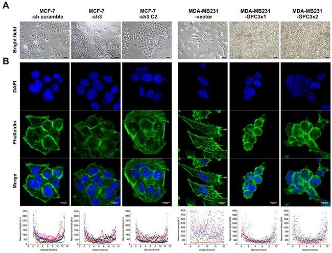 https://cdn.ncbi.nlm.nih.gov/pmc/blobs/b09c/5312374/61f88b757083/oncotarget-07-60133-g002.jpg