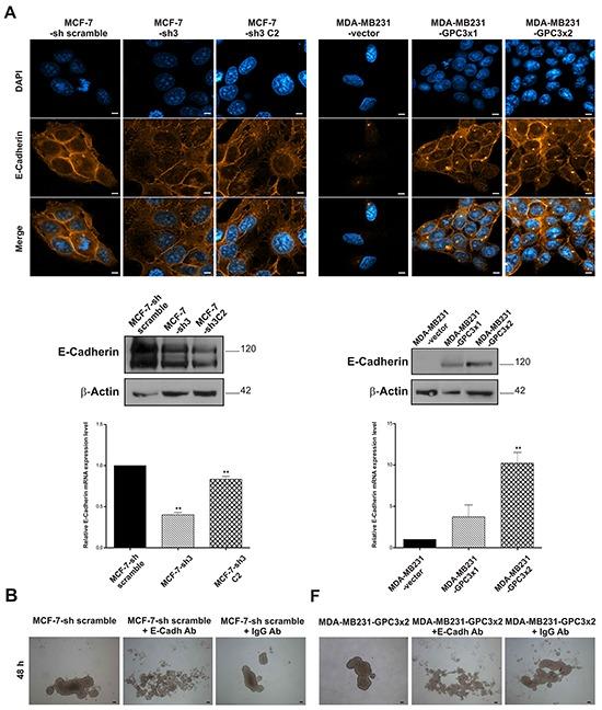 https://cdn.ncbi.nlm.nih.gov/pmc/blobs/b09c/5312374/7479bc940edd/oncotarget-07-60133-g007.jpg