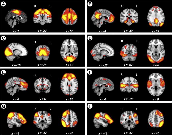 https://cdn.ncbi.nlm.nih.gov/pmc/blobs/b09d/3991849/32612cc8ced0/gr2.jpg