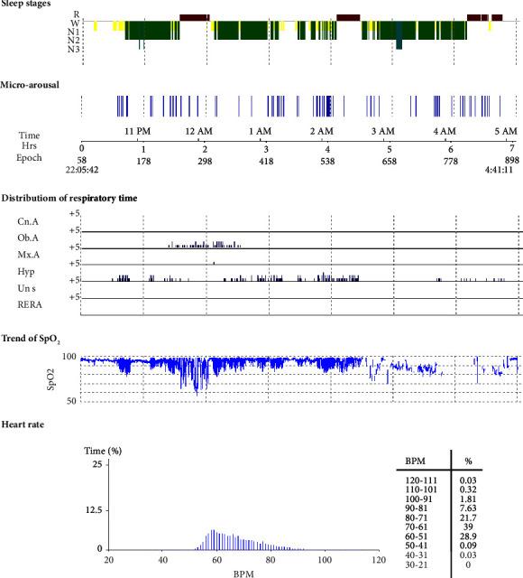 https://cdn.ncbi.nlm.nih.gov/pmc/blobs/b0a0/10959586/add0578e9ad6/CRJ2024-4071131.004.jpg
