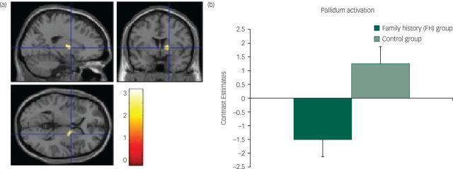 https://cdn.ncbi.nlm.nih.gov/pmc/blobs/b0a0/4995168/aeec8f18dc68/bjporcpsych002550-g003.jpg