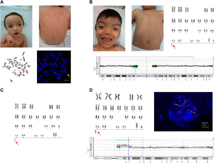 https://cdn.ncbi.nlm.nih.gov/pmc/blobs/b0a2/11071077/35dfa86e9f07/fgene-15-1356786-g001.jpg