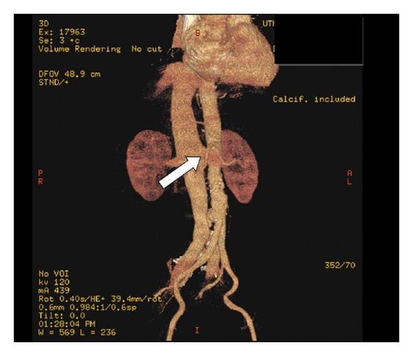 https://cdn.ncbi.nlm.nih.gov/pmc/blobs/b0ad/3546445/5896092c4d27/CRIM.SURGERY2012-487079.001.jpg