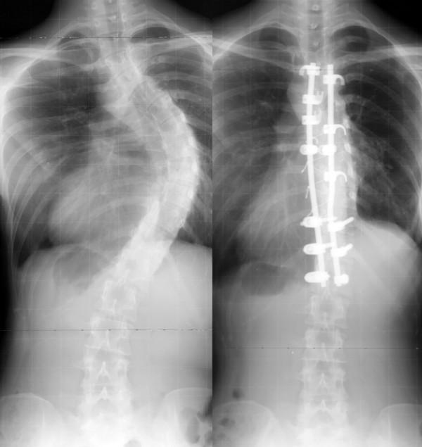 https://cdn.ncbi.nlm.nih.gov/pmc/blobs/b0b5/2346456/054f675bc9d3/1748-7161-3-6-3.jpg