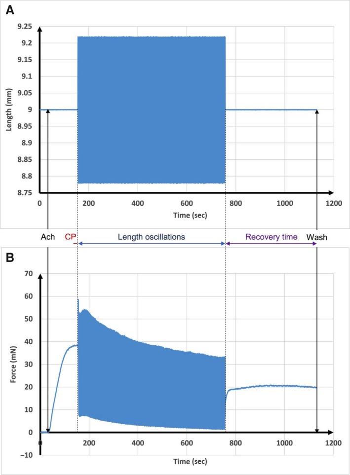 https://cdn.ncbi.nlm.nih.gov/pmc/blobs/b0b8/5269406/c85a094b2ebf/PHY2-5-e13076-g002.jpg