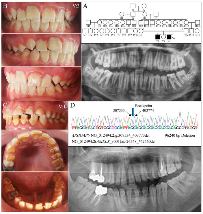 https://cdn.ncbi.nlm.nih.gov/pmc/blobs/b0bf/11172428/392872adf408/ijms-25-06132-g006.jpg