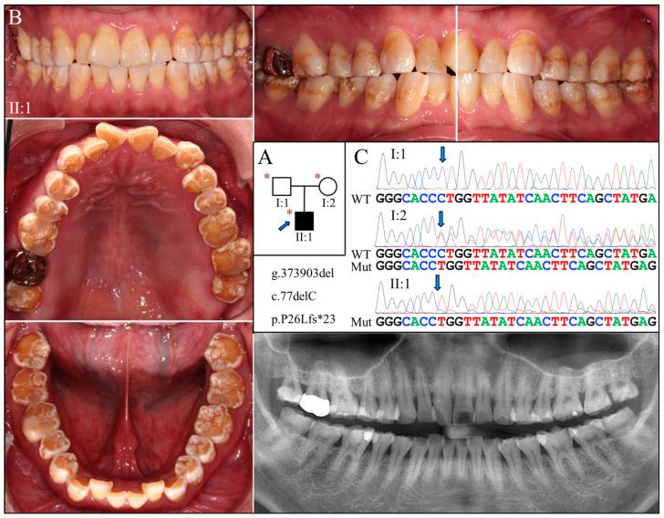 https://cdn.ncbi.nlm.nih.gov/pmc/blobs/b0bf/11172428/4c7d1acdcbf5/ijms-25-06132-g004.jpg