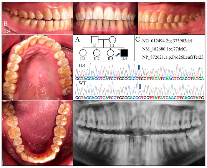 https://cdn.ncbi.nlm.nih.gov/pmc/blobs/b0bf/11172428/5720a4037b7e/ijms-25-06132-g003.jpg