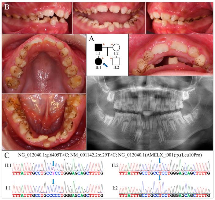 https://cdn.ncbi.nlm.nih.gov/pmc/blobs/b0bf/11172428/9b96f7c6d140/ijms-25-06132-g002.jpg