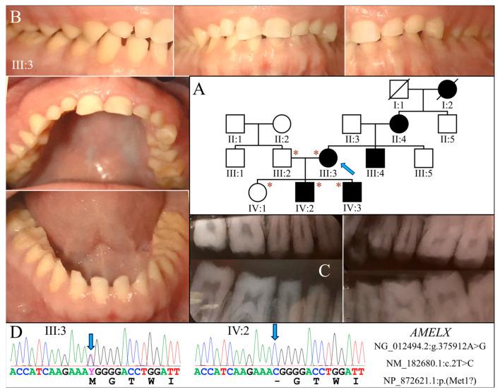 https://cdn.ncbi.nlm.nih.gov/pmc/blobs/b0bf/11172428/bbd5673c523a/ijms-25-06132-g001.jpg