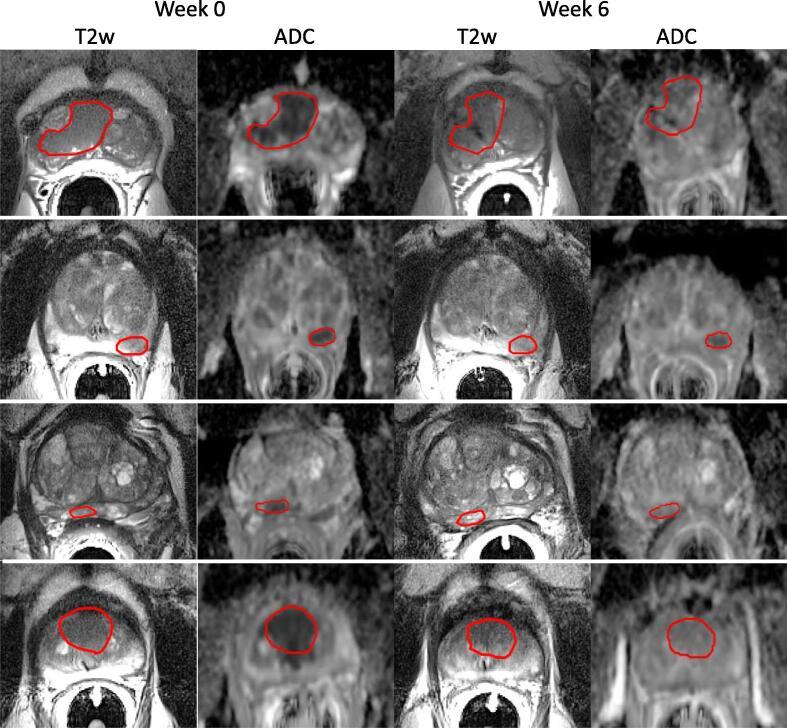 https://cdn.ncbi.nlm.nih.gov/pmc/blobs/b0c0/7807683/5f6eb228f006/gr1.jpg