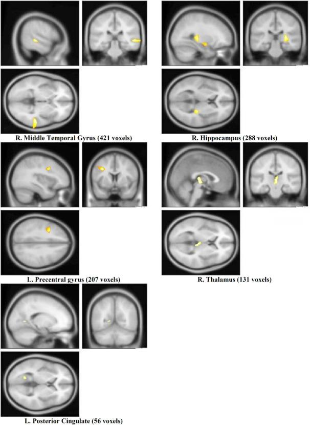 https://cdn.ncbi.nlm.nih.gov/pmc/blobs/b0c1/7878053/9f38a4608c8e/BCN-11-669-g003.jpg