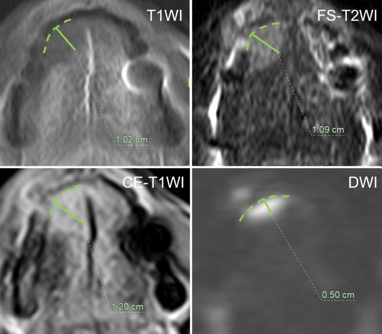 https://cdn.ncbi.nlm.nih.gov/pmc/blobs/b0c3/11996252/8ea1ff872eba/mrms-24-210-s1.jpg