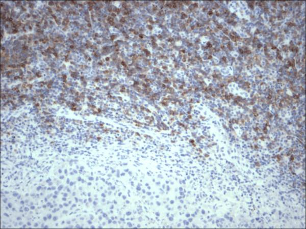 https://cdn.ncbi.nlm.nih.gov/pmc/blobs/b0c8/2040134/55c7bc406902/1746-1596-2-34-4.jpg