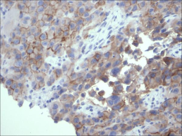 https://cdn.ncbi.nlm.nih.gov/pmc/blobs/b0c8/2040134/a01af8c2ec7e/1746-1596-2-34-6.jpg
