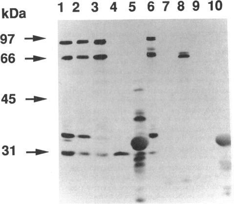 https://cdn.ncbi.nlm.nih.gov/pmc/blobs/b0cb/205162/96450a29d9af/jbacter00022-0171-a.jpg
